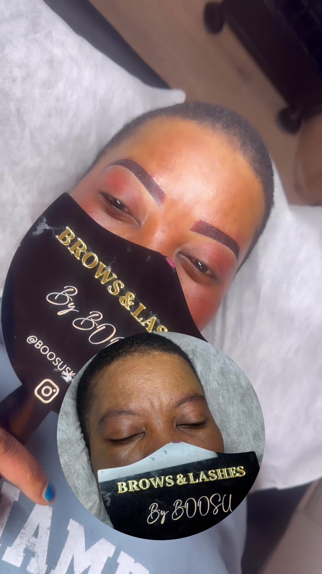 @@Boosu Beauty clinic