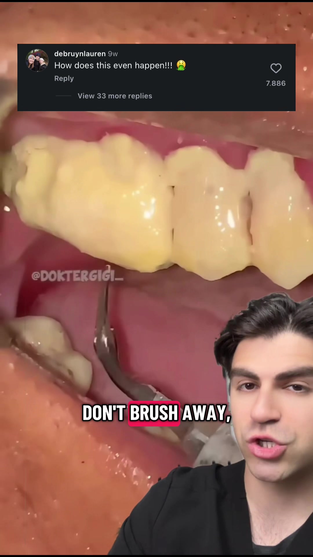 @Dr. Kadish