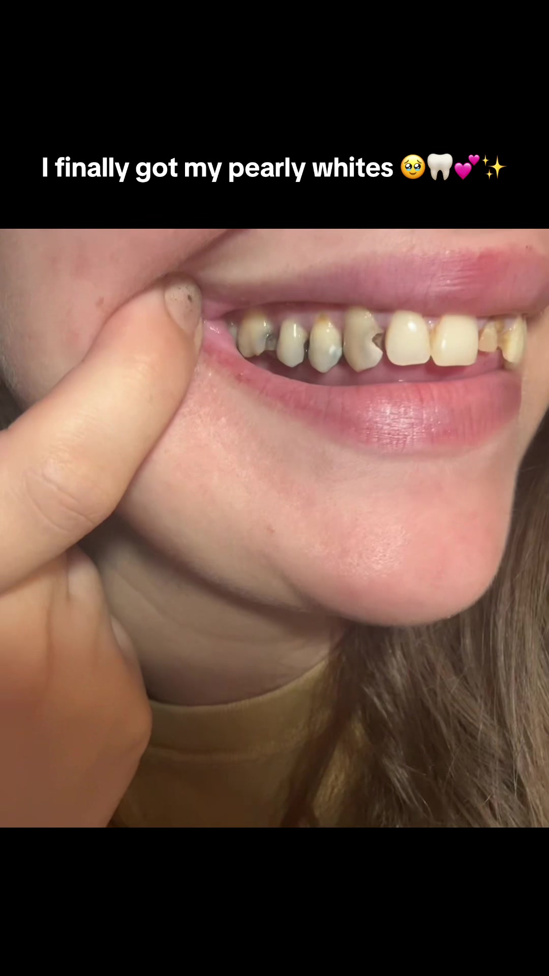 @TruthInMyTeeth