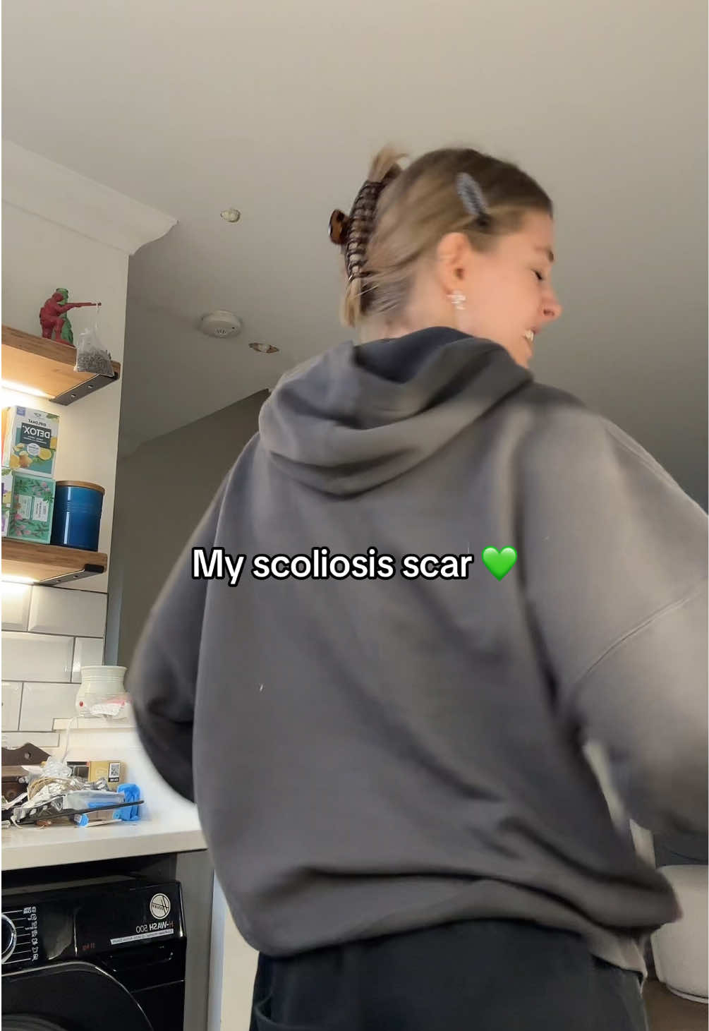 @𝐋𝐈𝐕 🪼