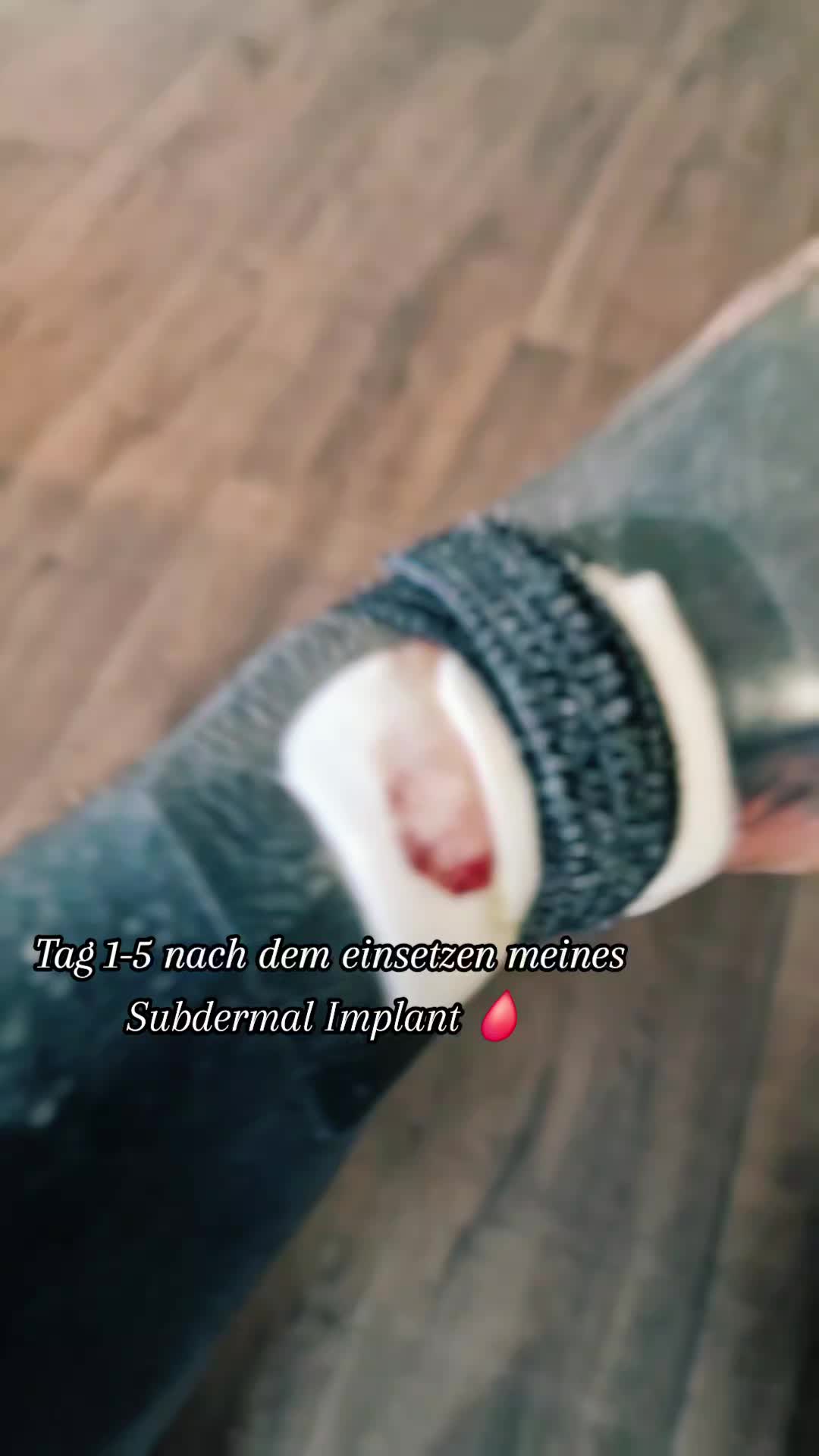 @su1c1de_ink☠️