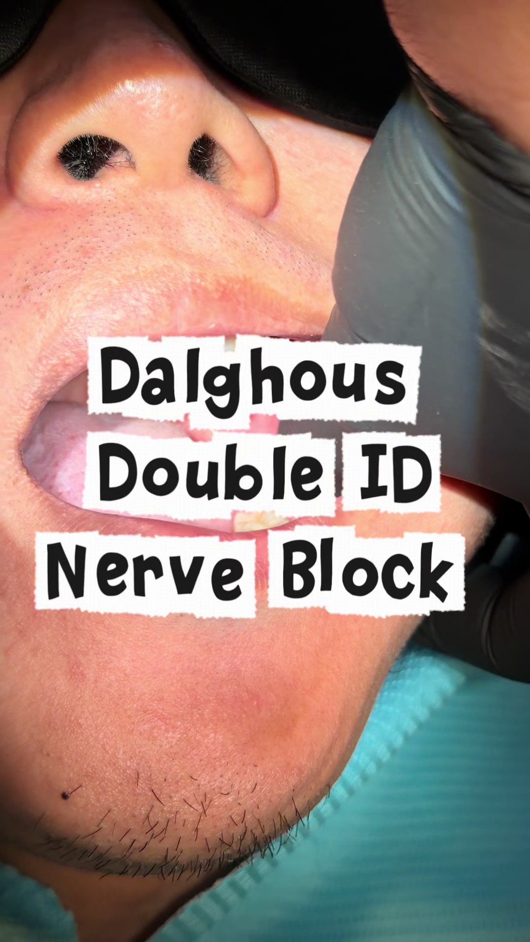 @Dr Dalghous