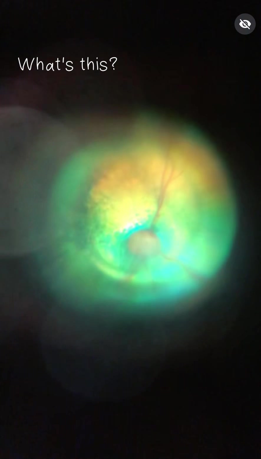 @Hiro|Orthoptist