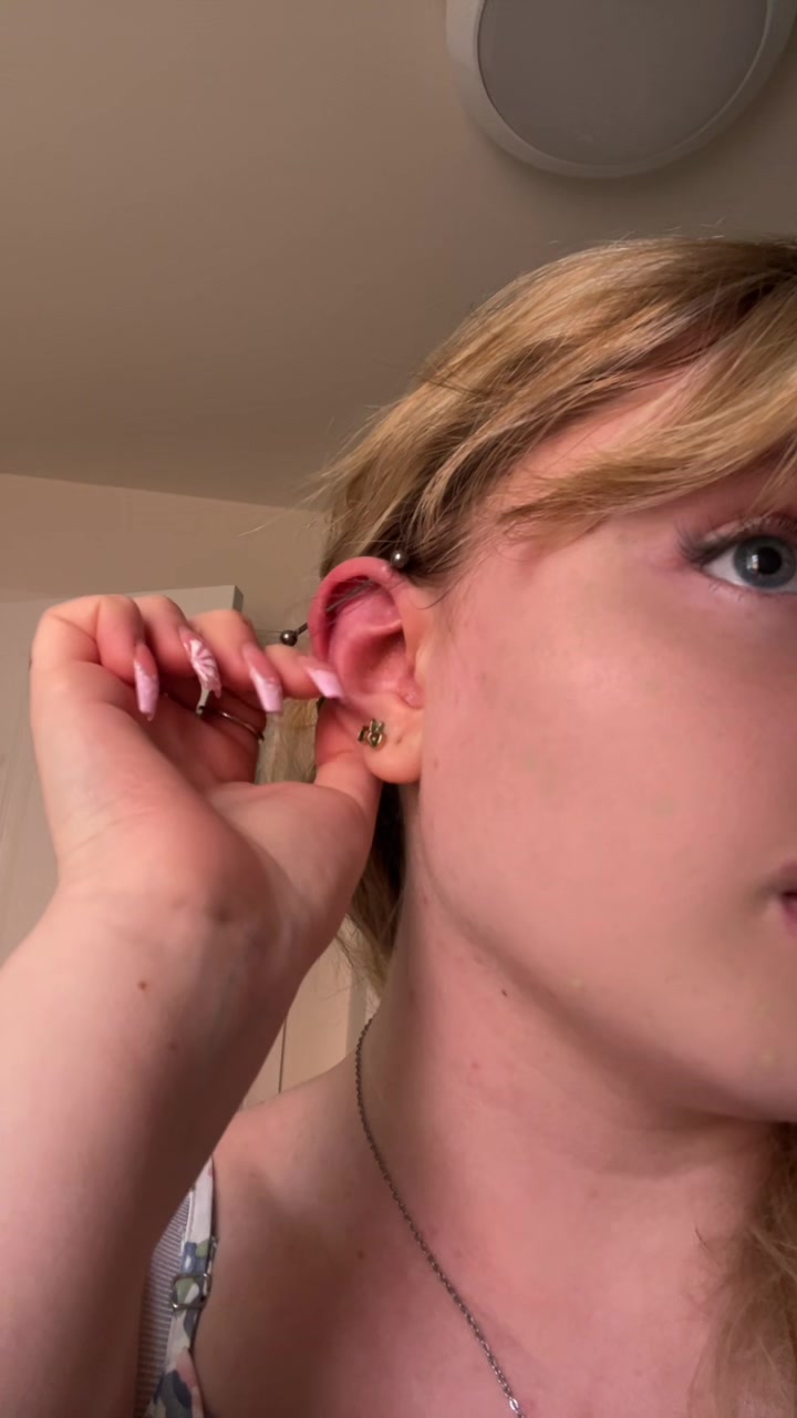 @Notchloe