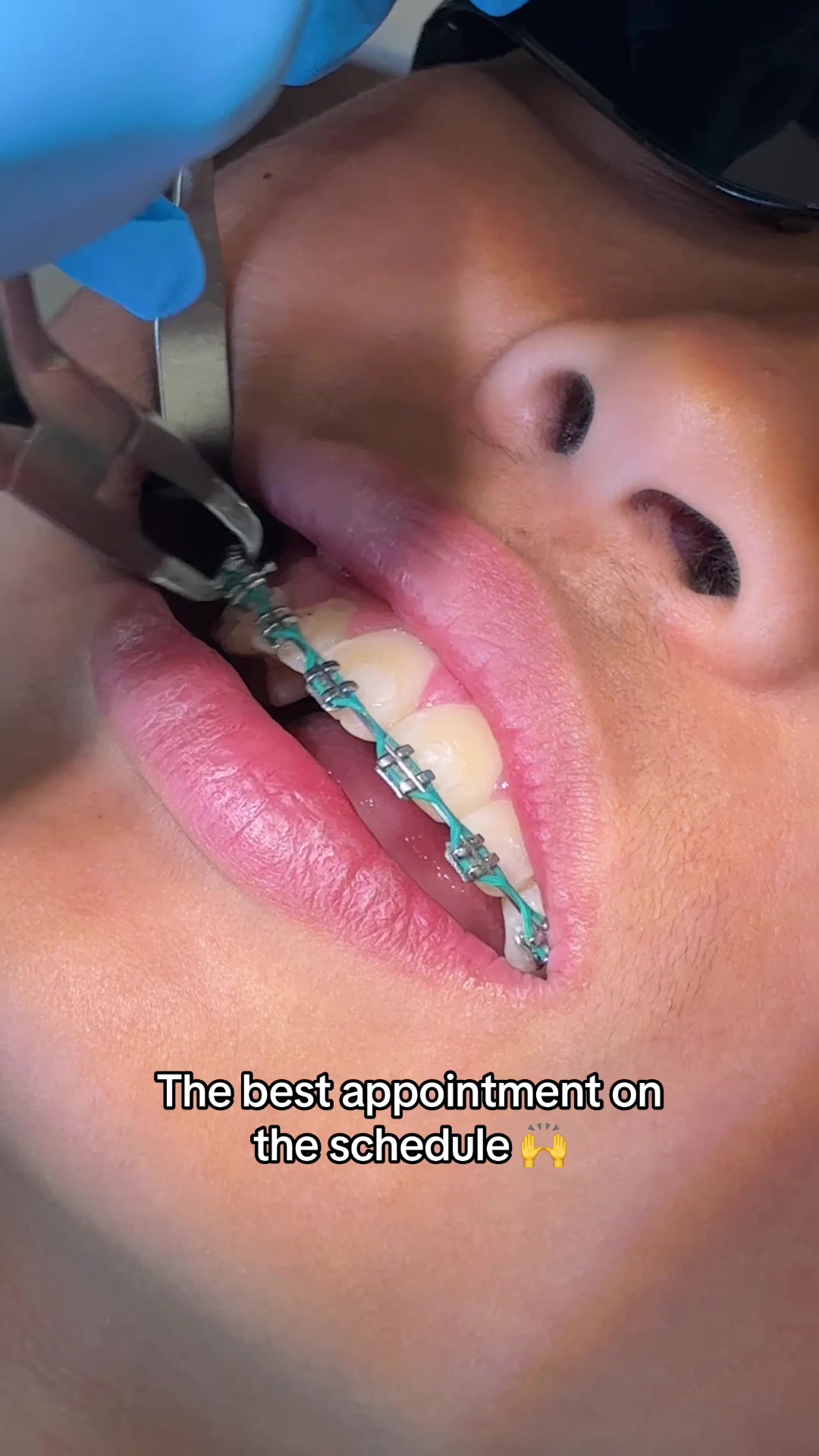 @Woodland Hills Orthodontist