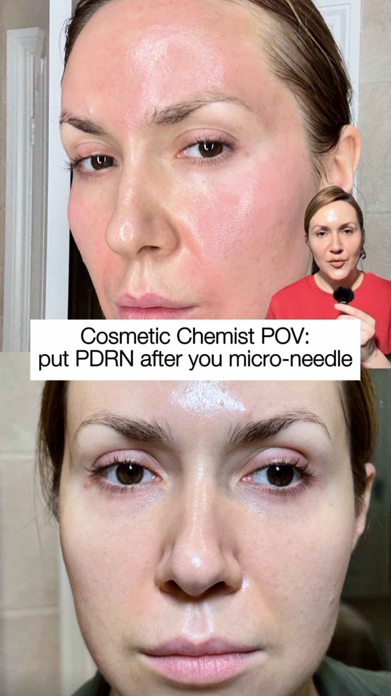 @Marina @4complexion