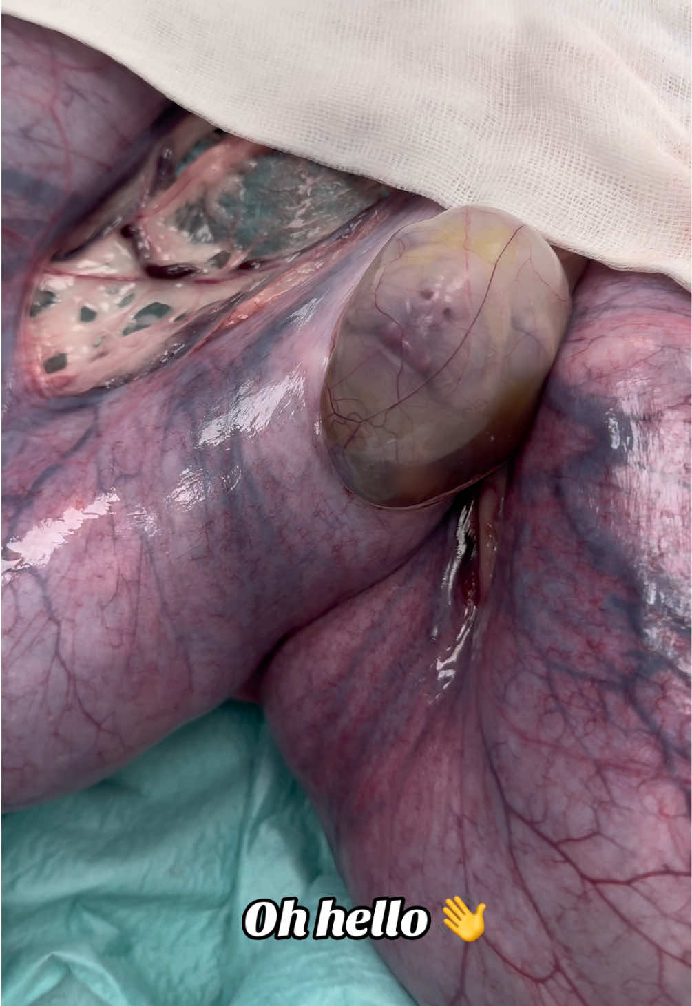 @Tomasthevet