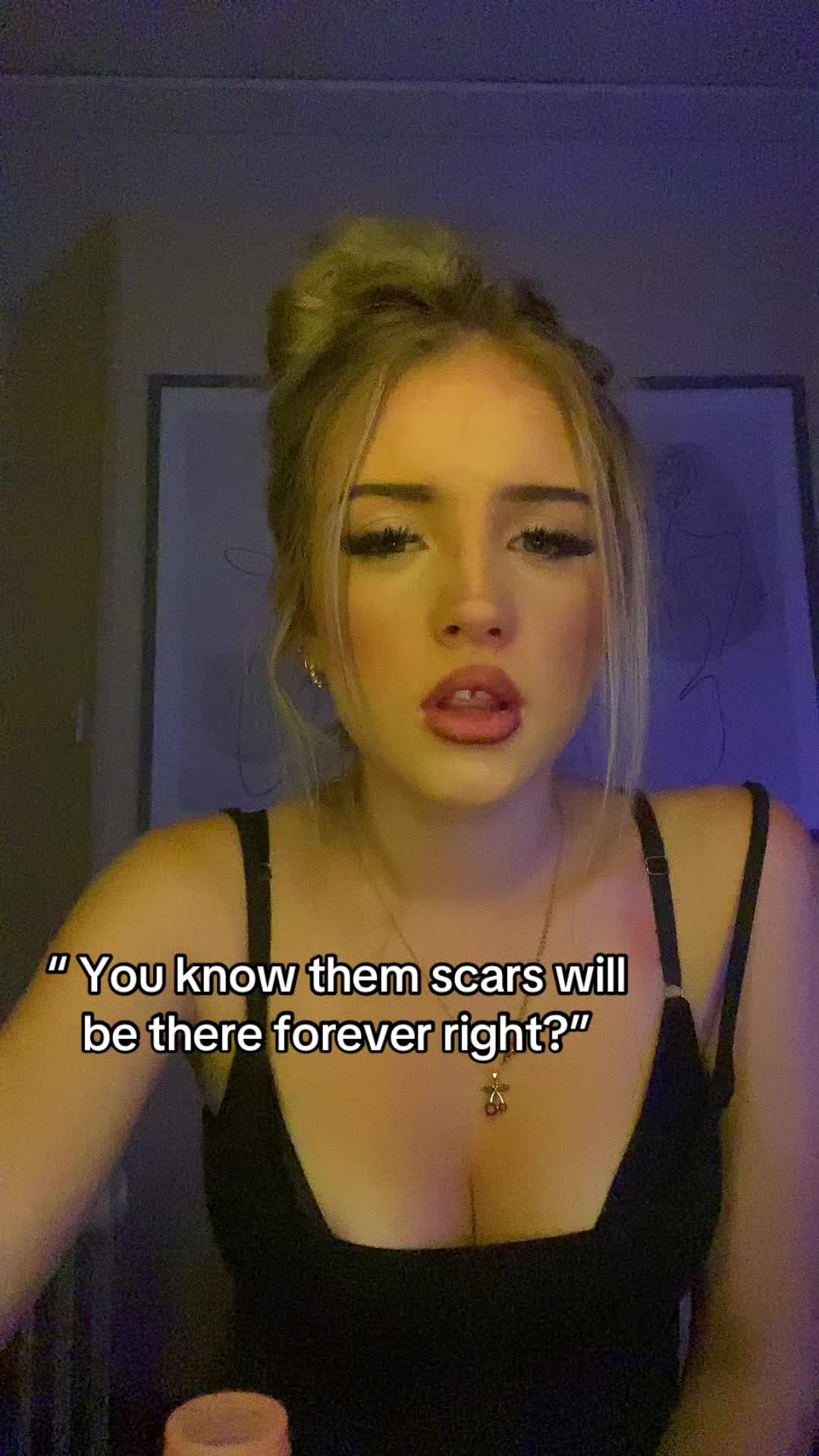 @X.pops_priv.x