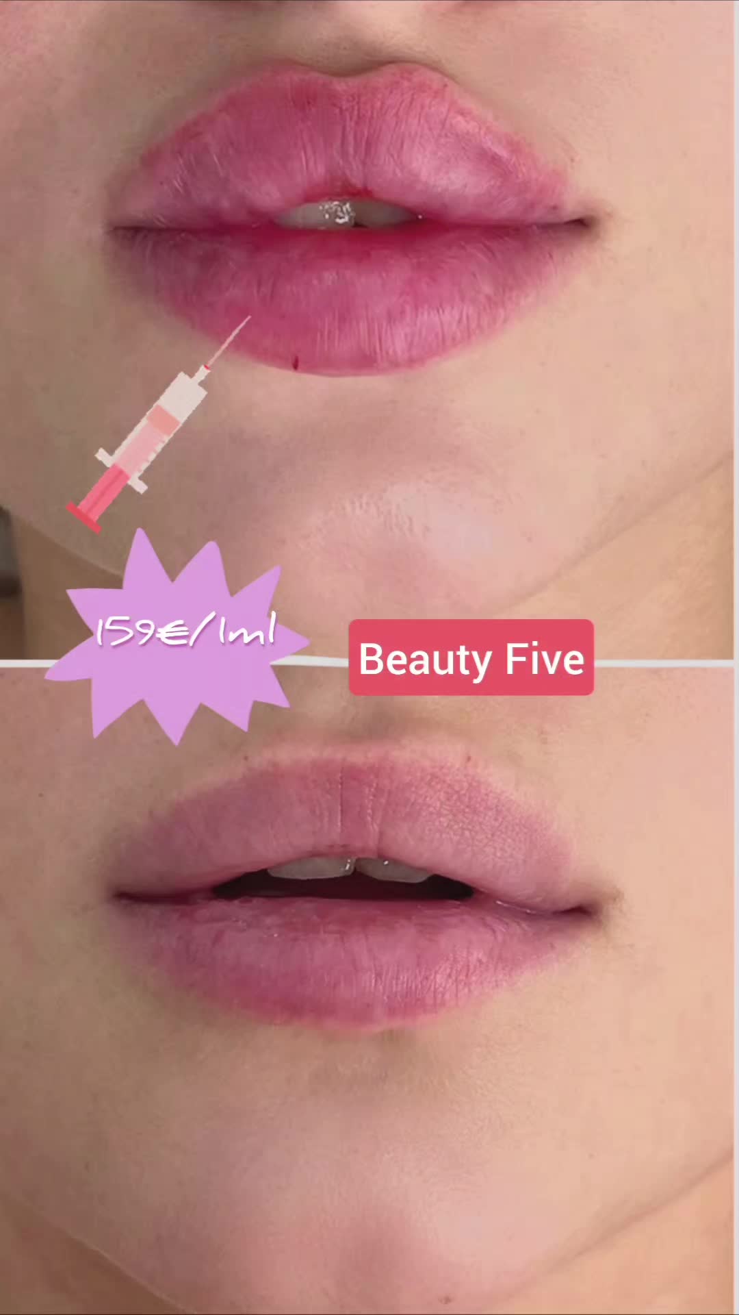 @Beauty Five