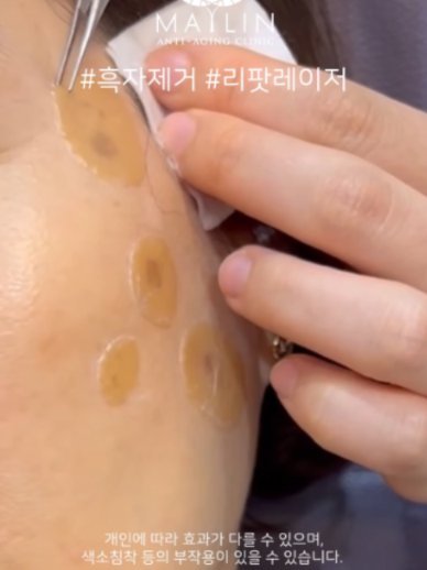 @메이린의원대구점