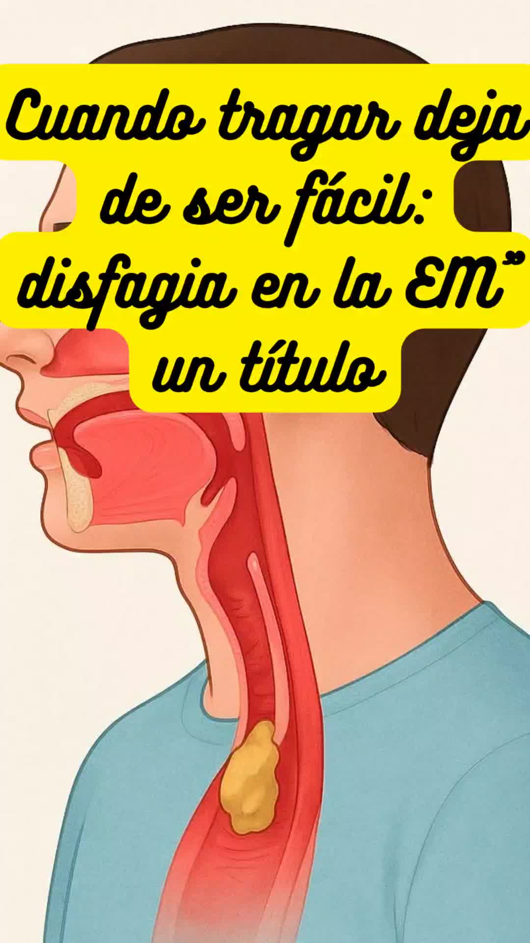 @Entendiendo la EM
