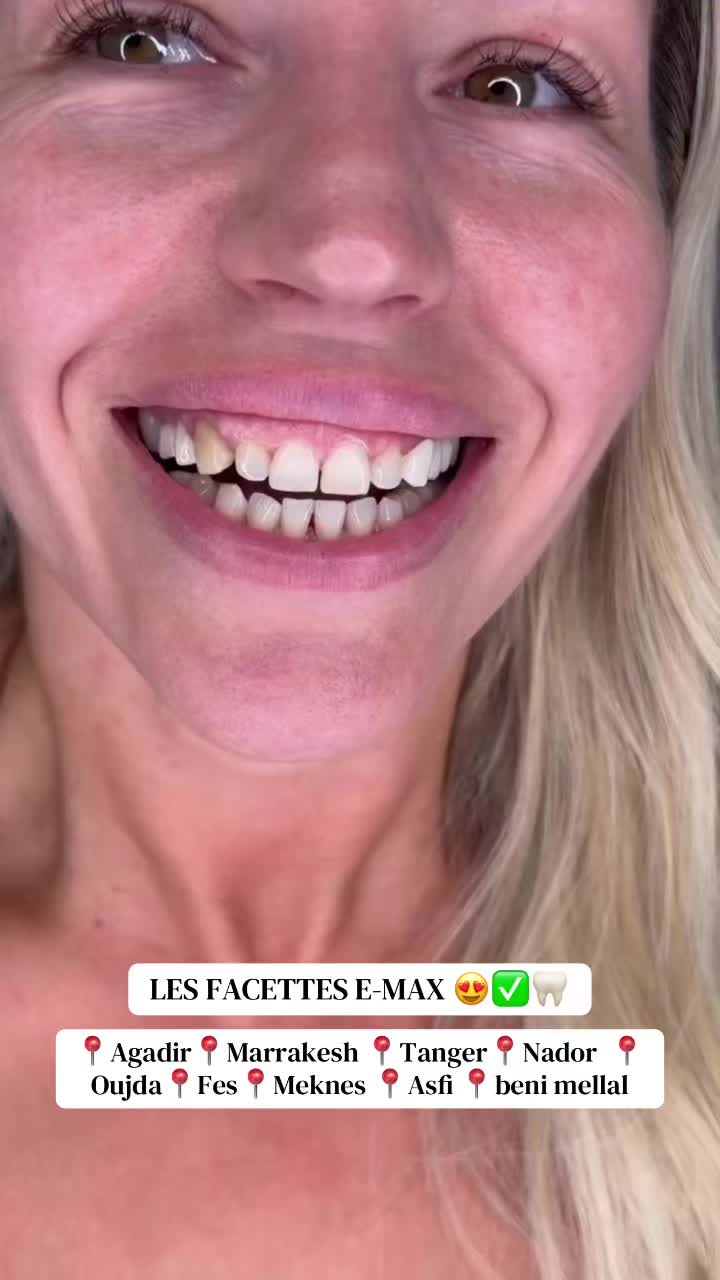 @brightsmileee1