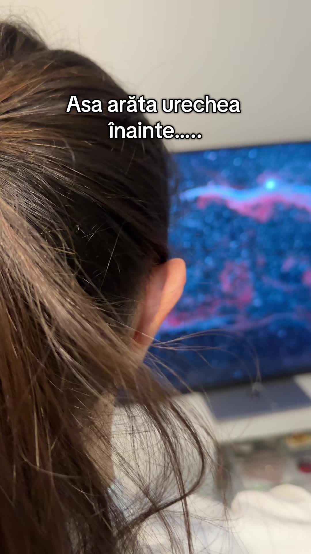 @Zenora