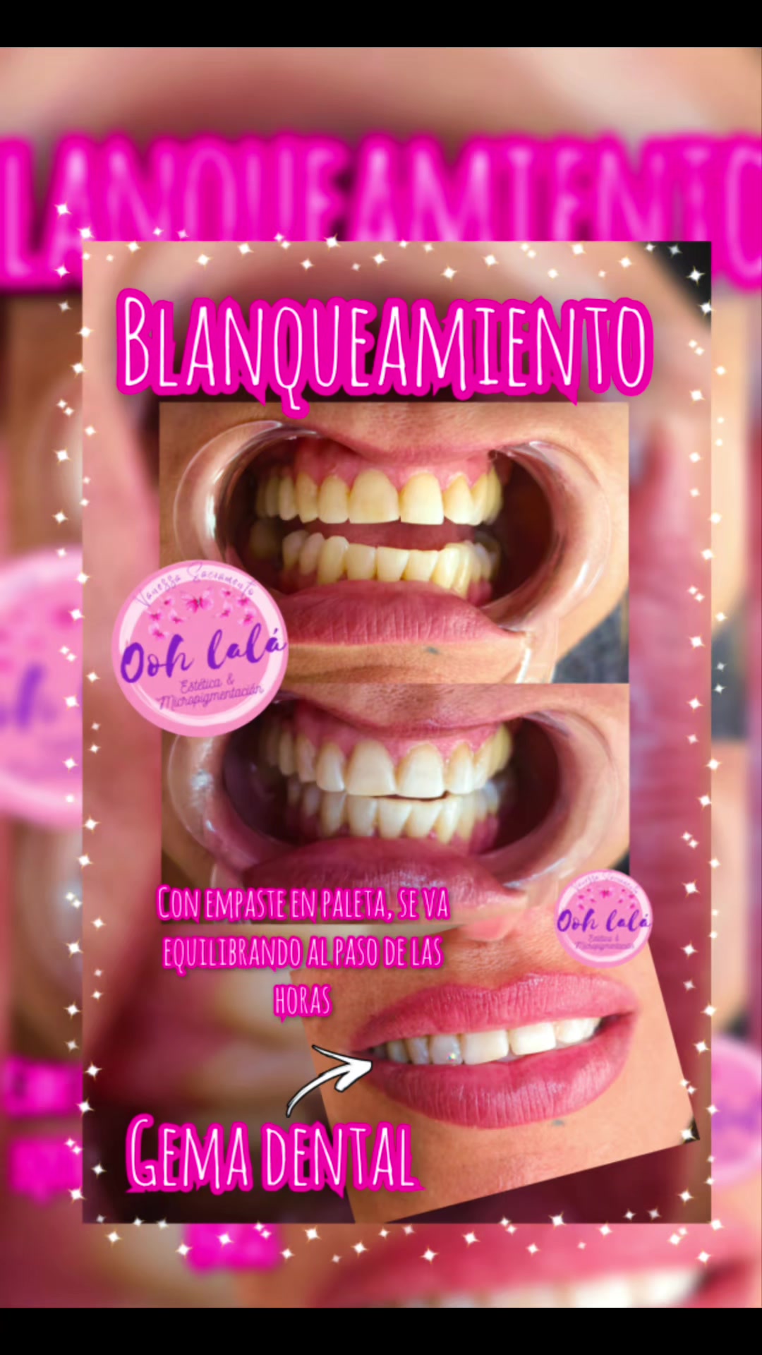 @Oohlal&aacute; Est&eacute;tic
