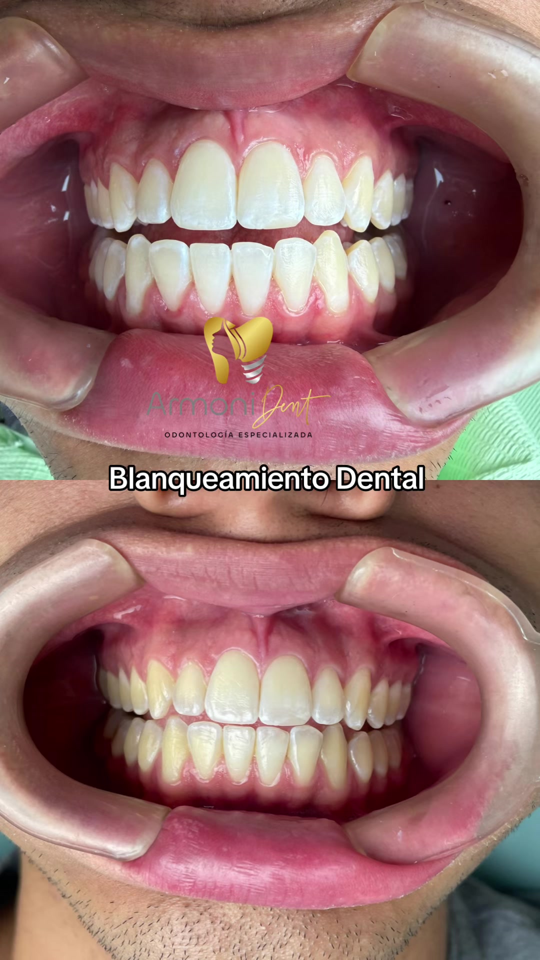 @ARMONI DENT