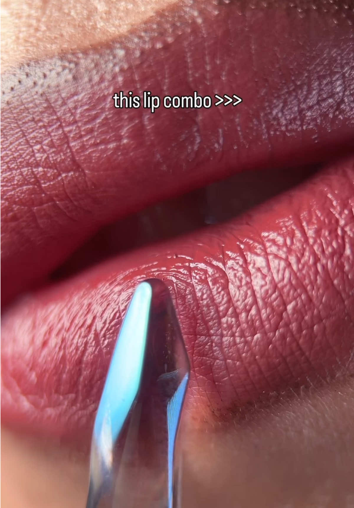 @Noelle