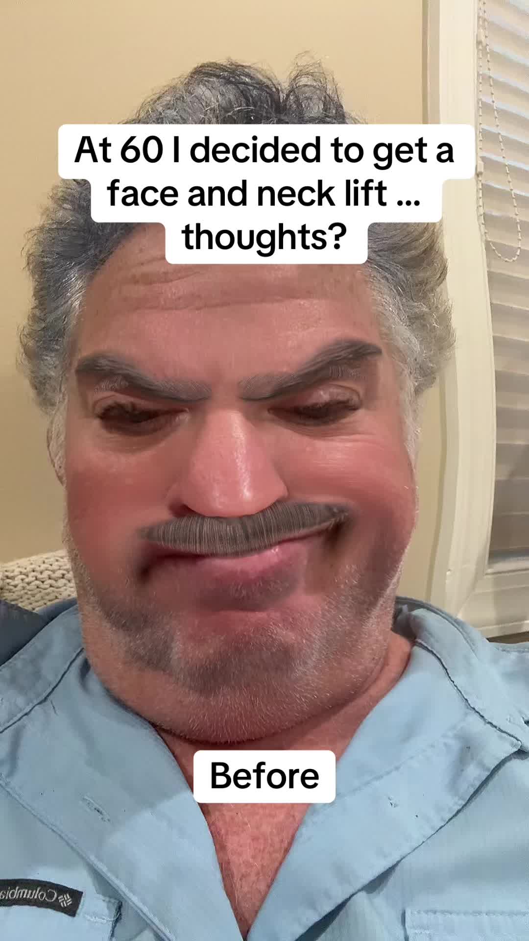 @Mr Morphman