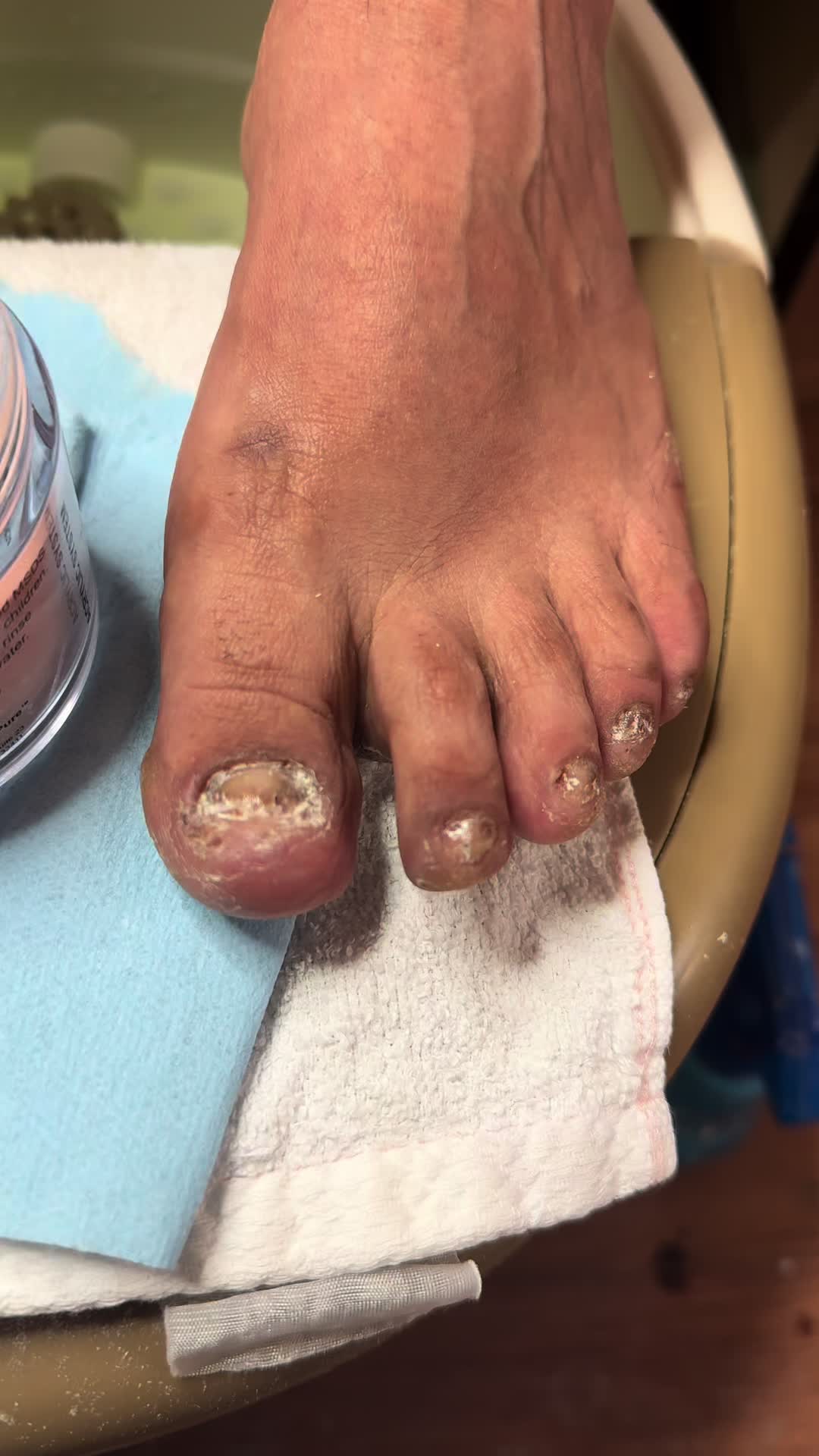 @ToesbyKoki