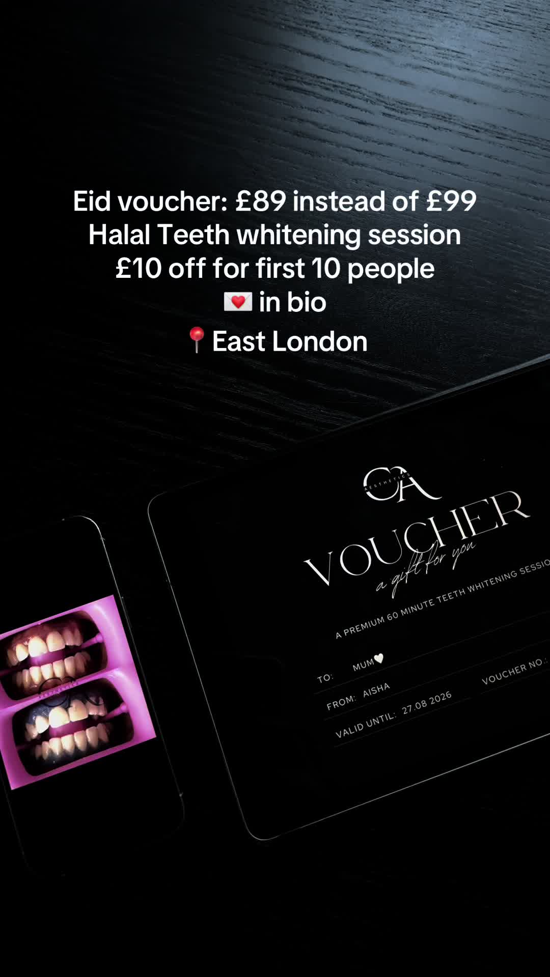 @Halal Teeth Whitening London