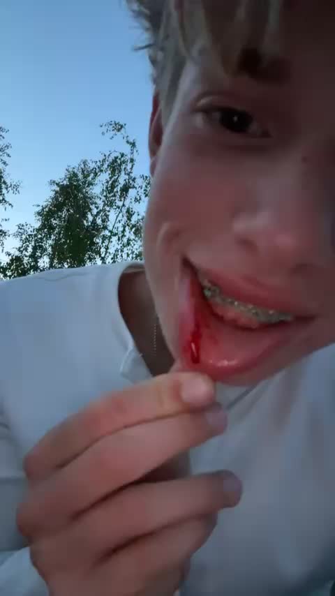 @skela.1