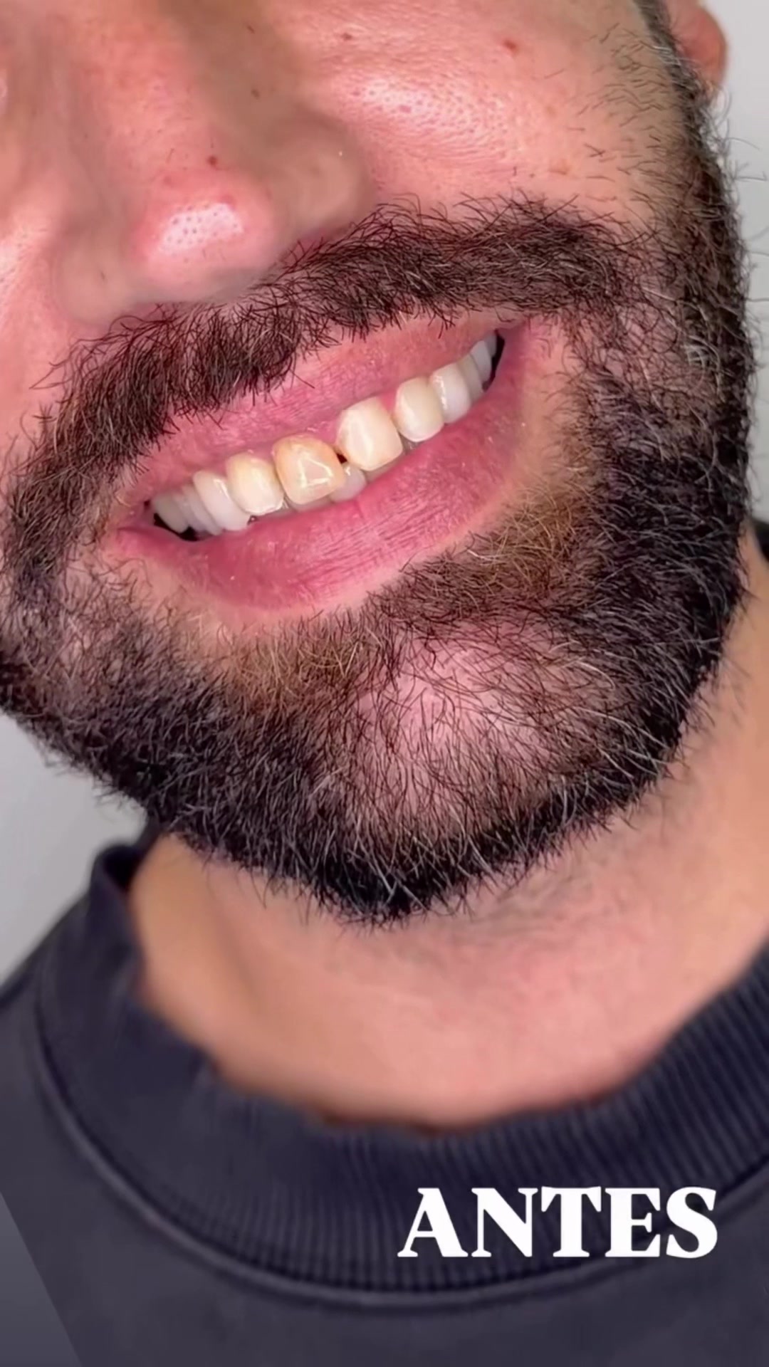 @Artista de sonrisas