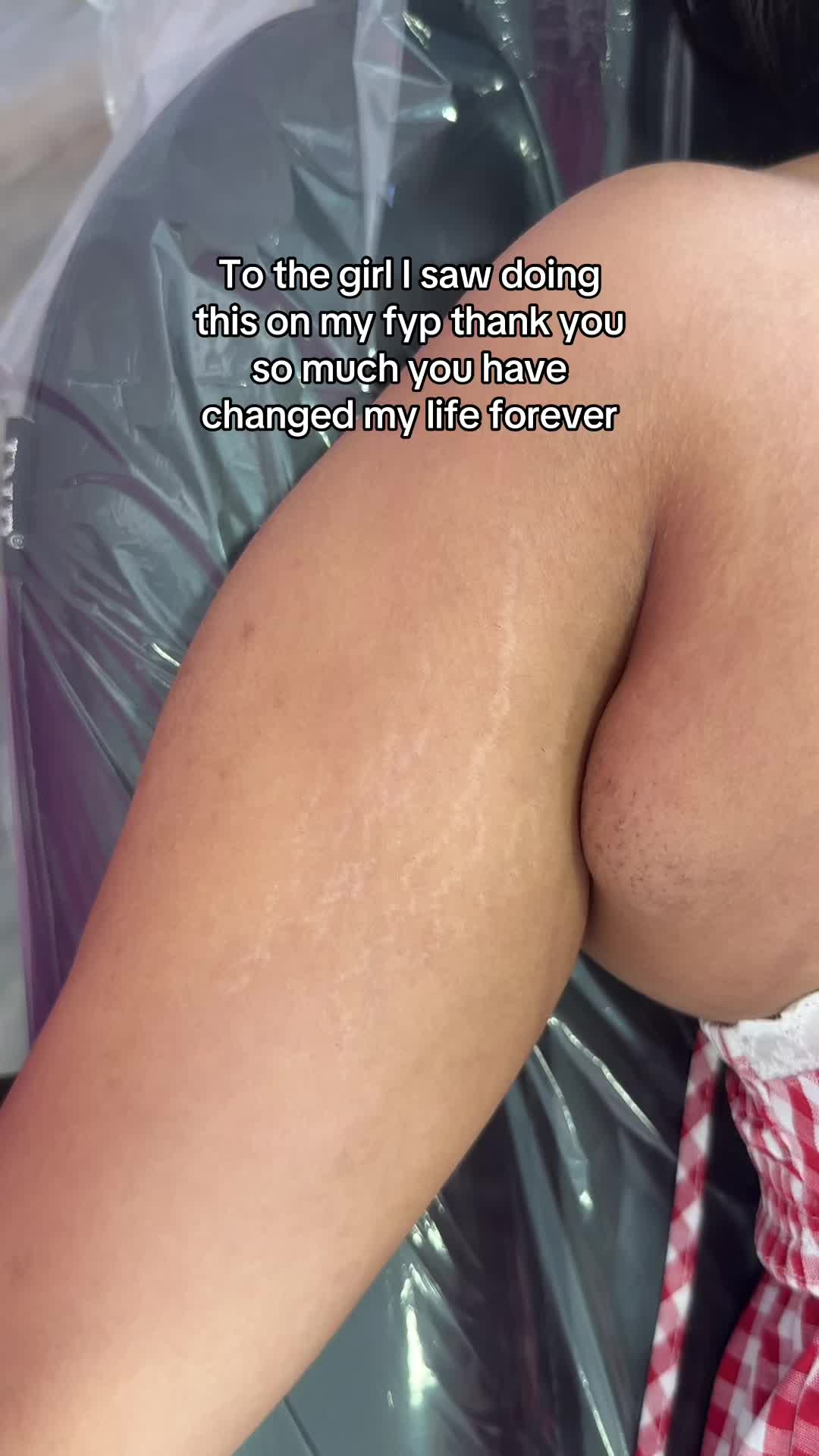@Stretch Mark Fairy 🧚✨
