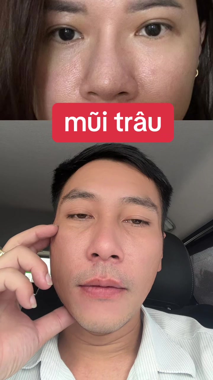 @Tuệ Nh&atilde;n ✅