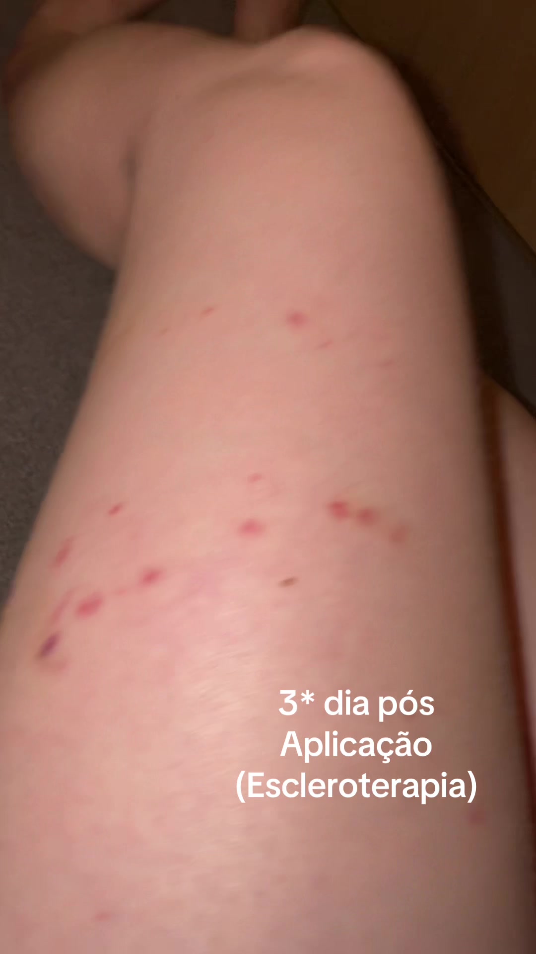 @Ingrid Peron