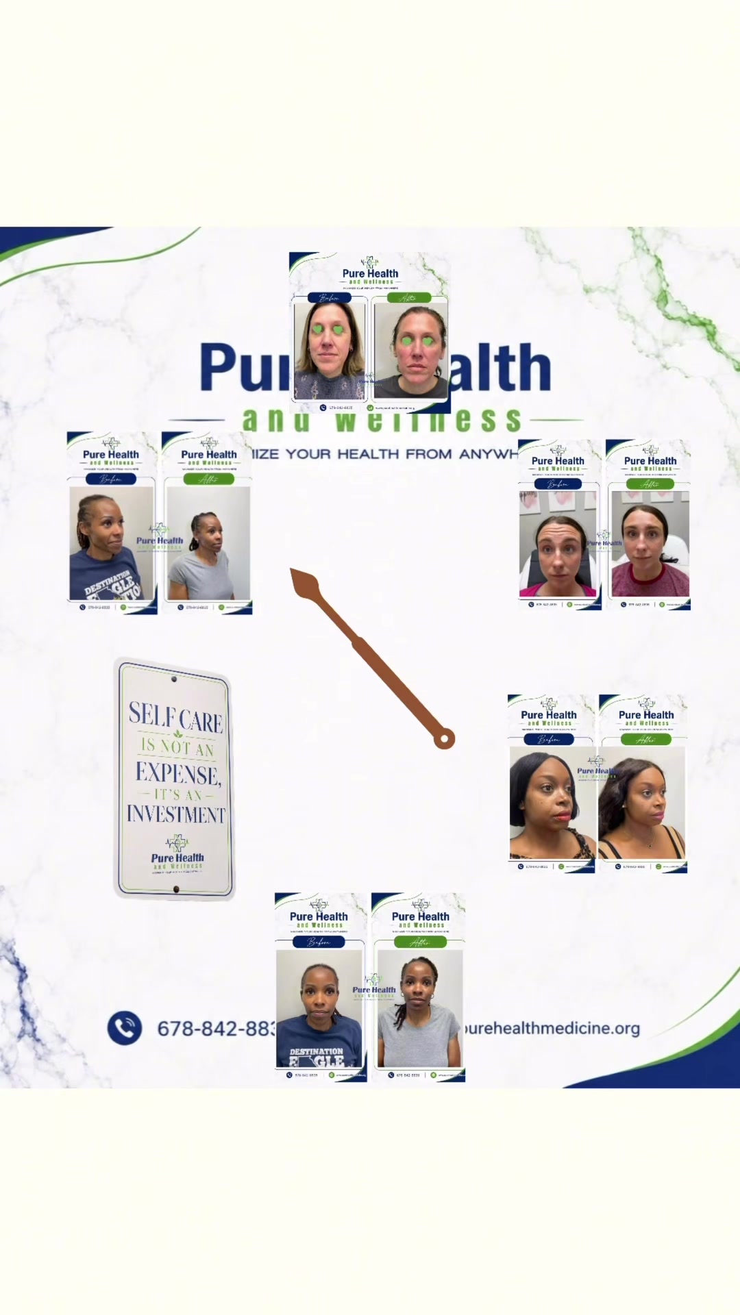 @PureHealthand_Wellness