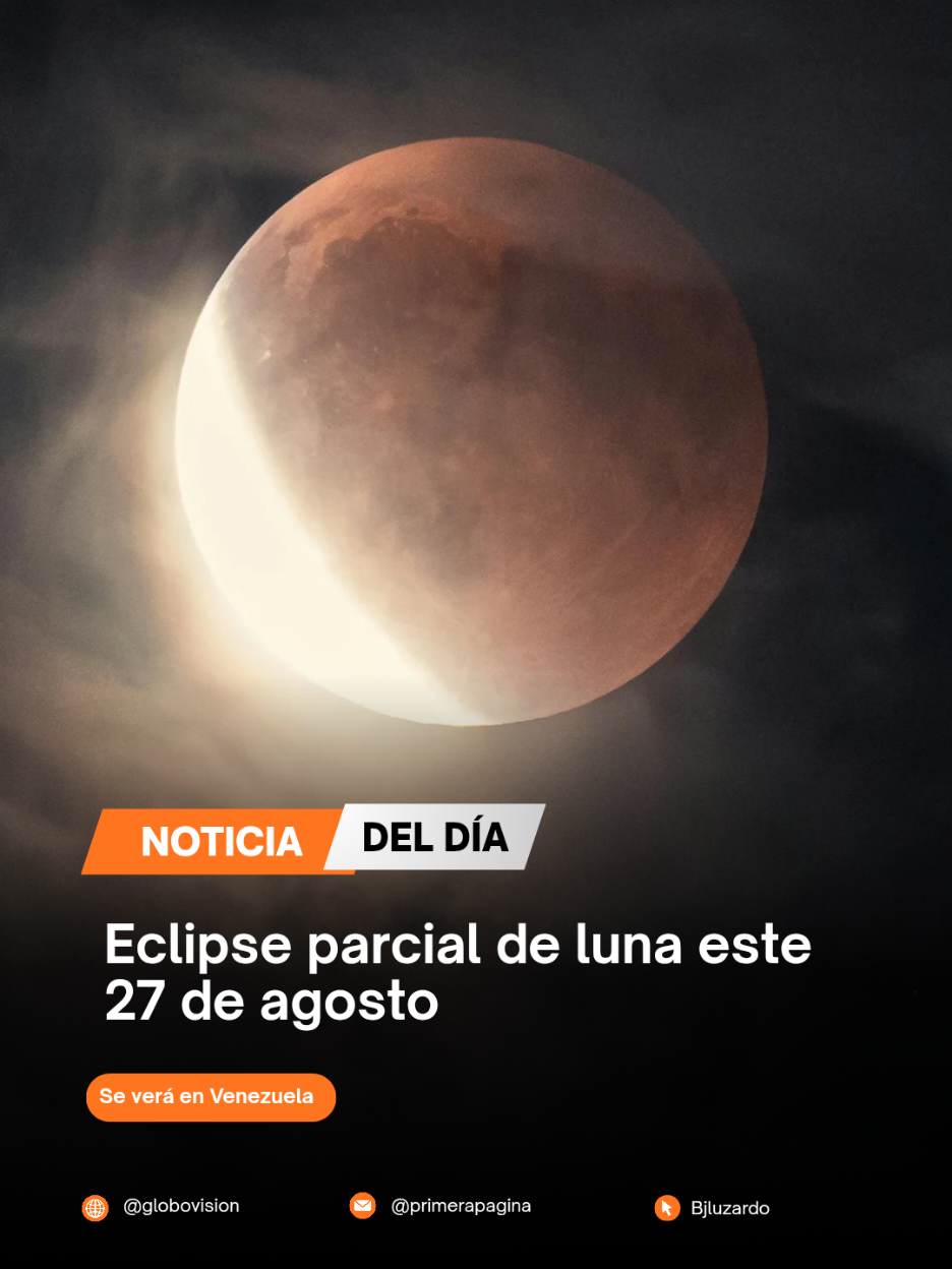 @Bernardo Luzardo