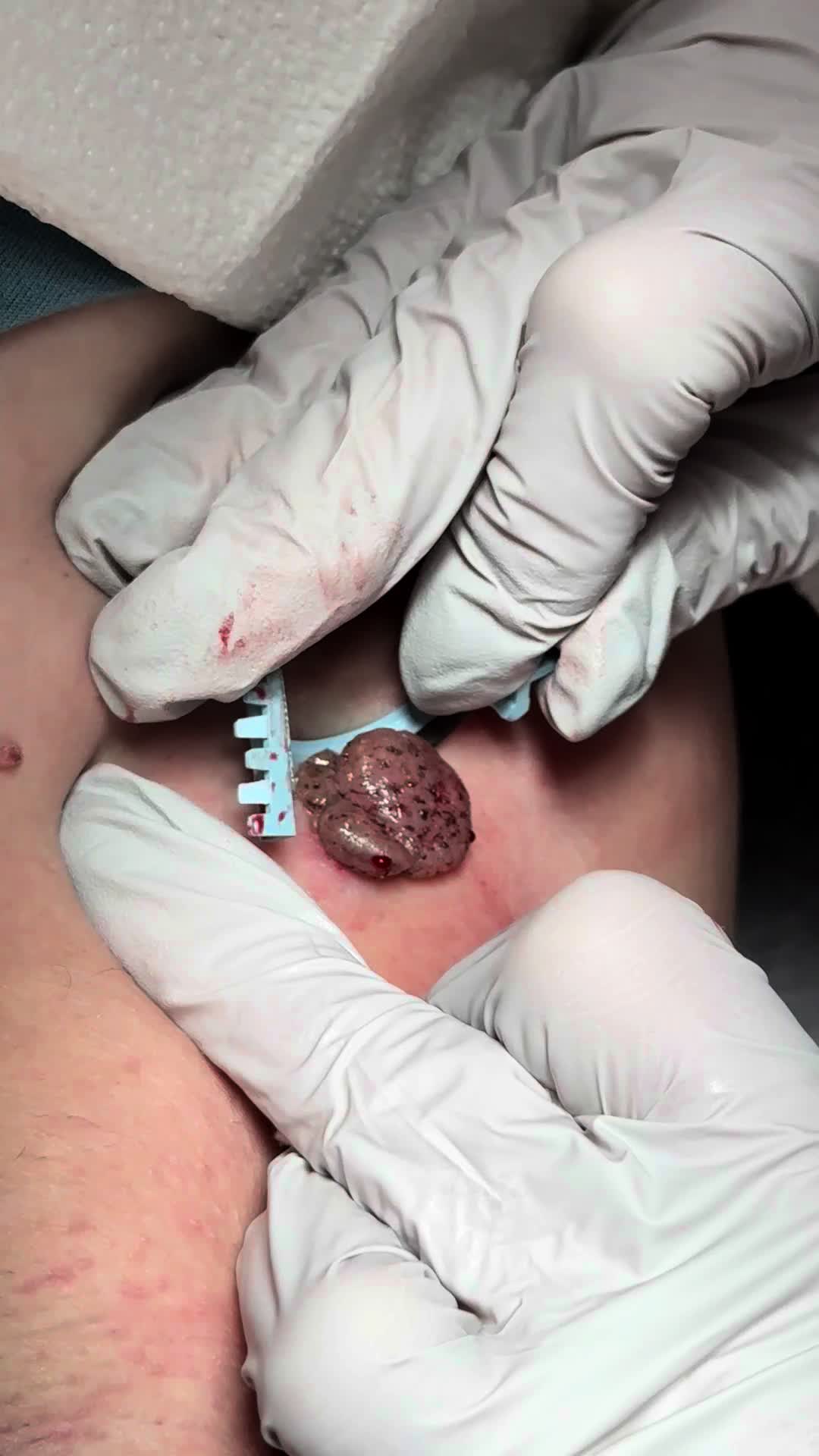 @Hala Koudsi M.D.