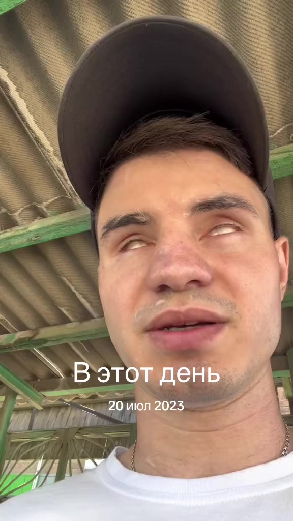 @Незрячий Эдик