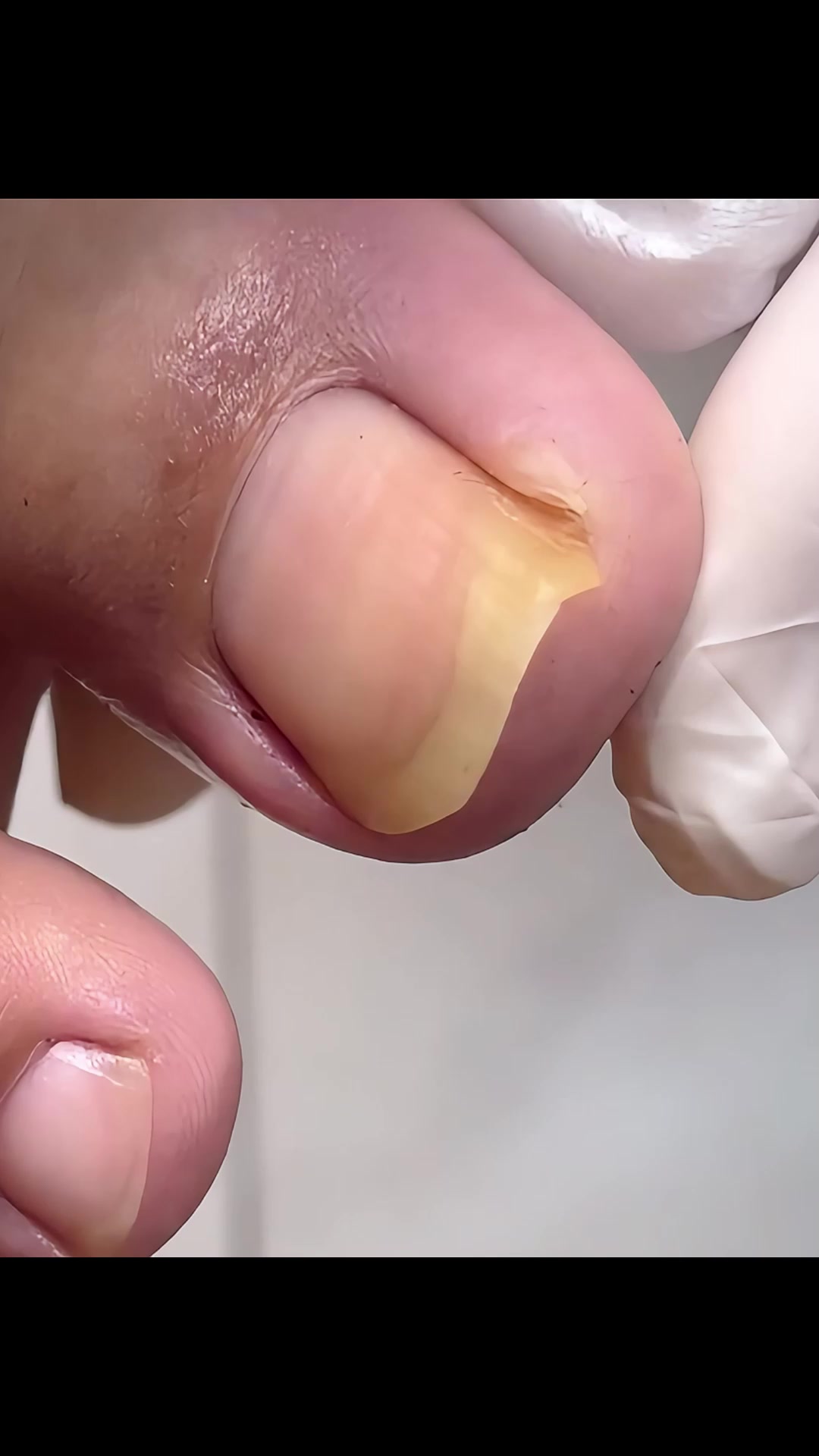 @Toenails.clips
