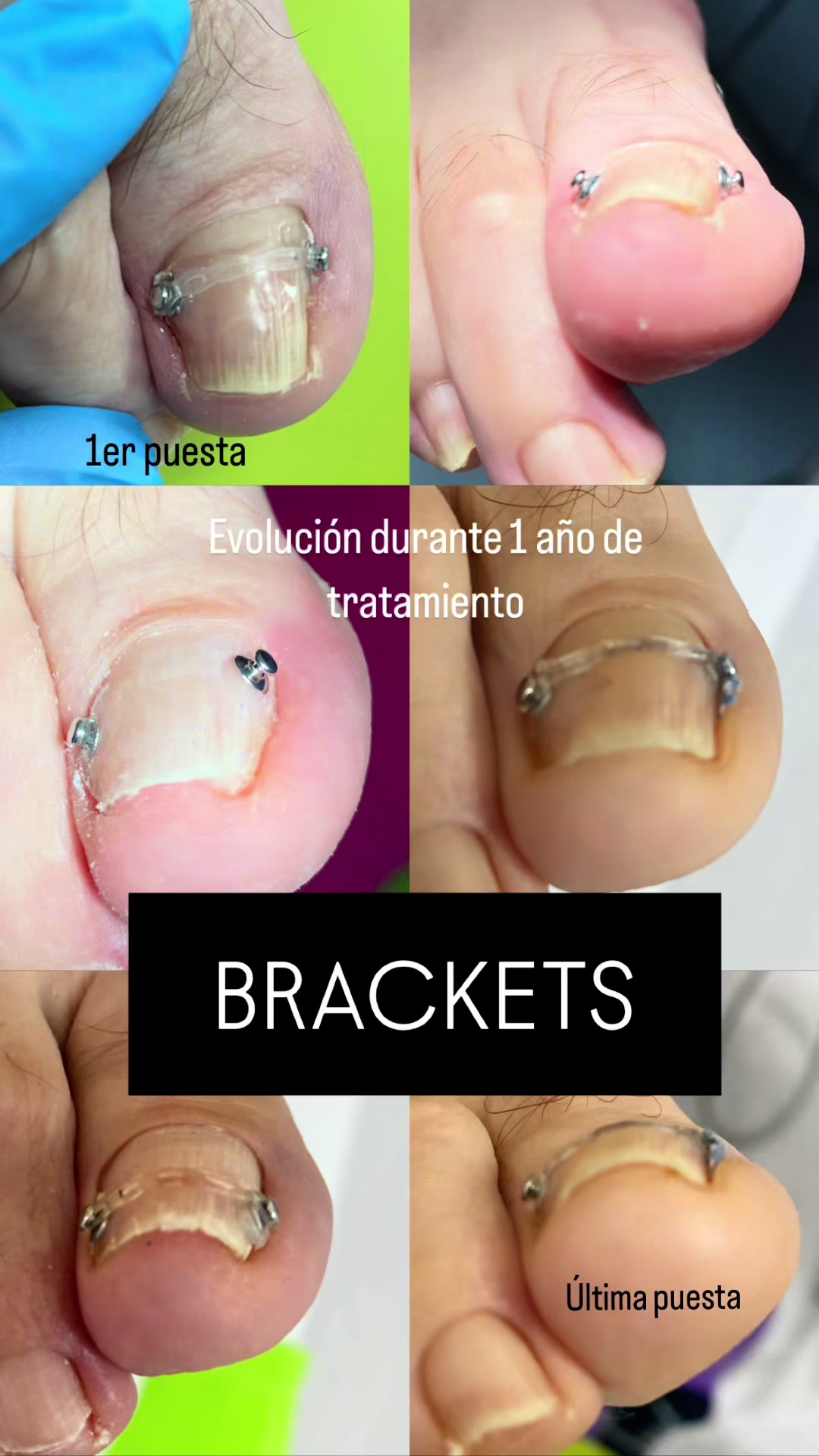 @Podolog&iacute;a Azahar