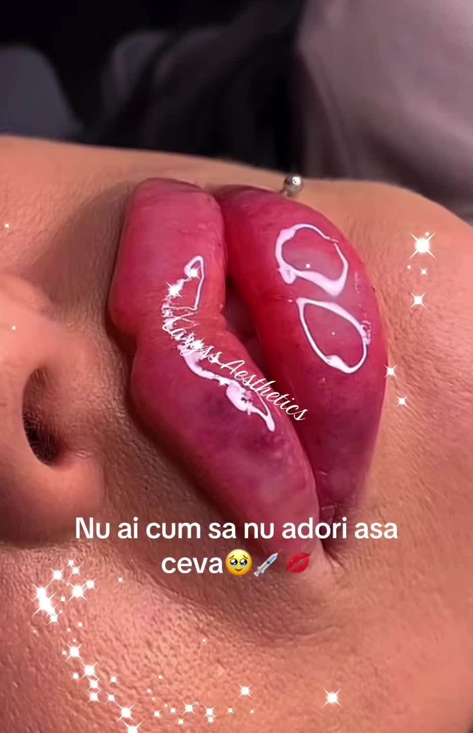 @laryssSebbyCataleya
