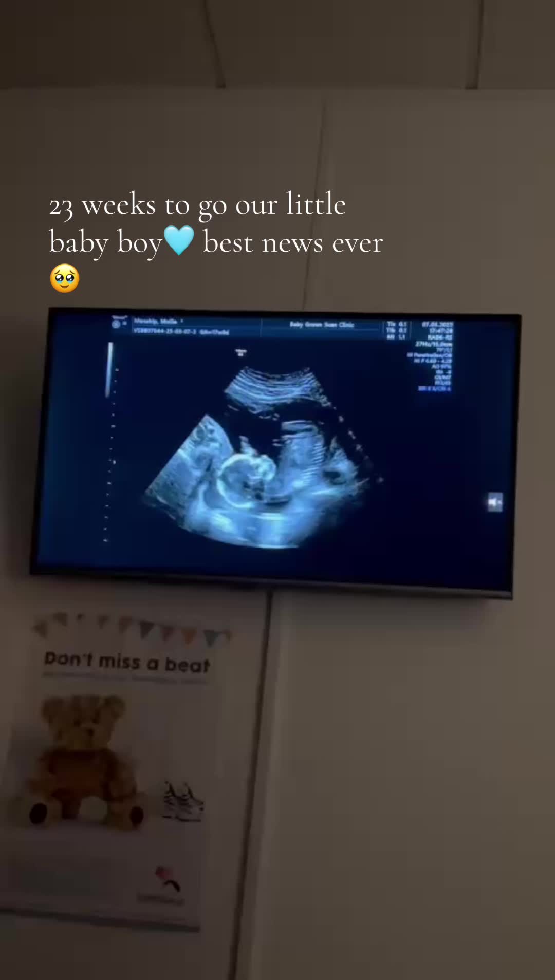 @𝐌𝐨𝐥𝐥𝐢𝐞🤍