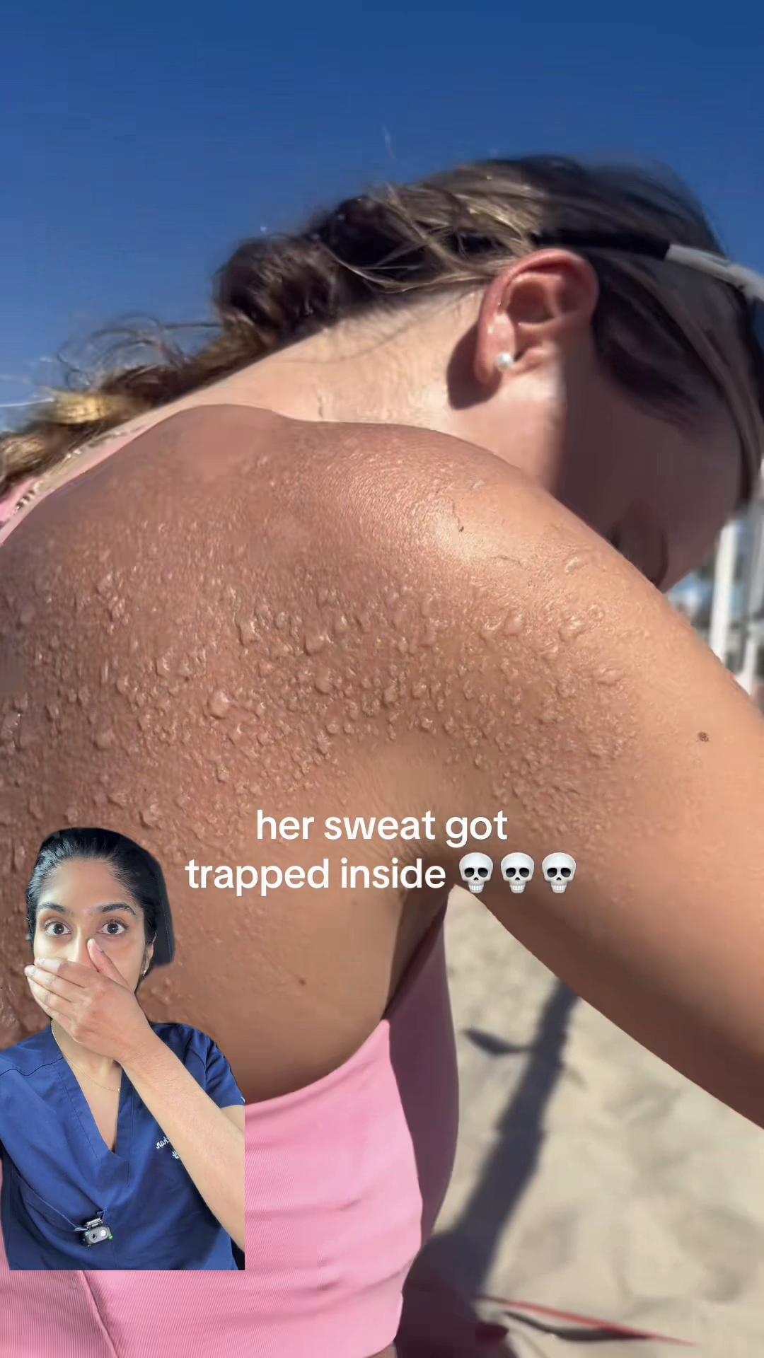 @Dr. Neera, Skin Surgeon