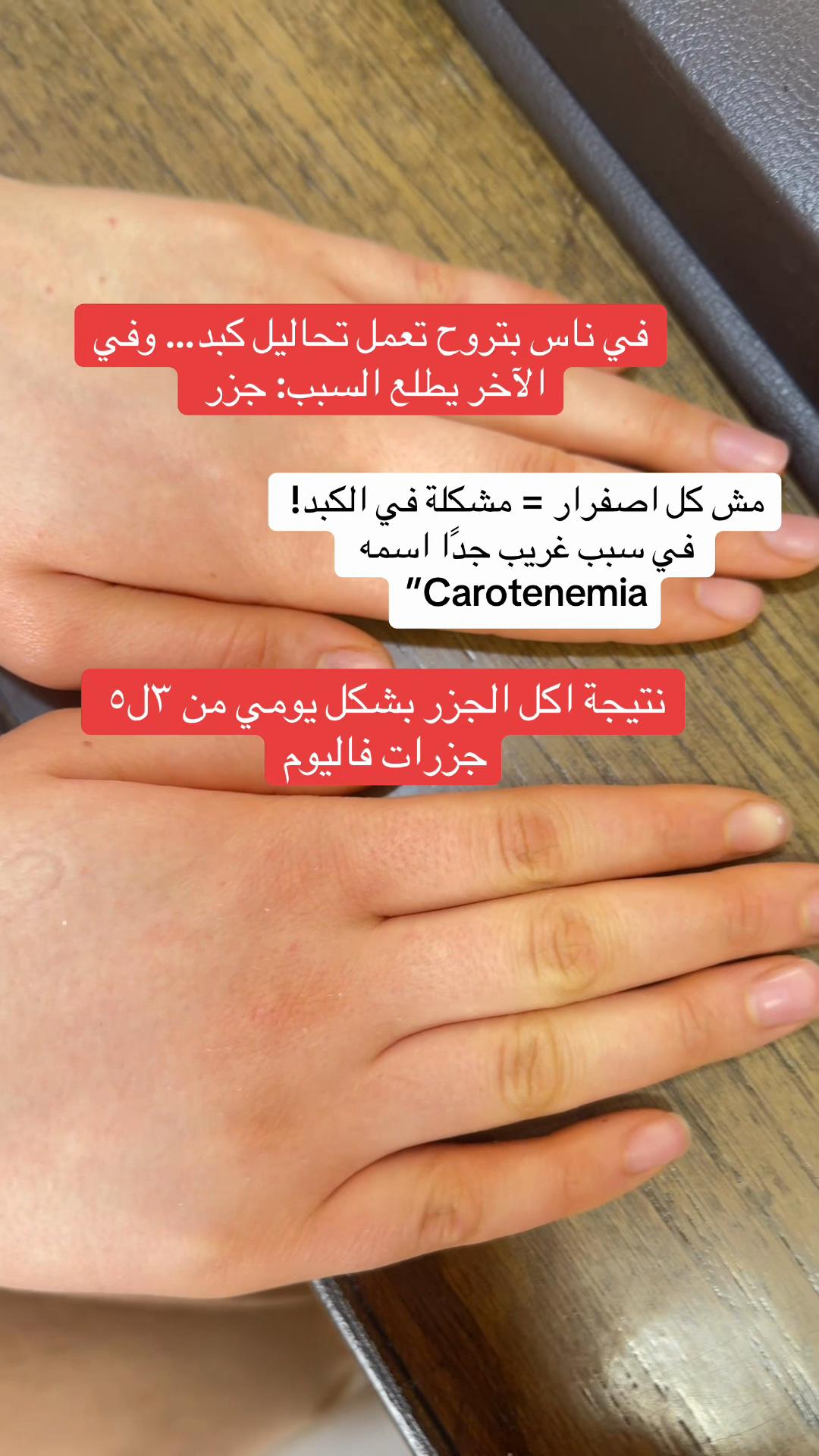 @د /آيات عثمان