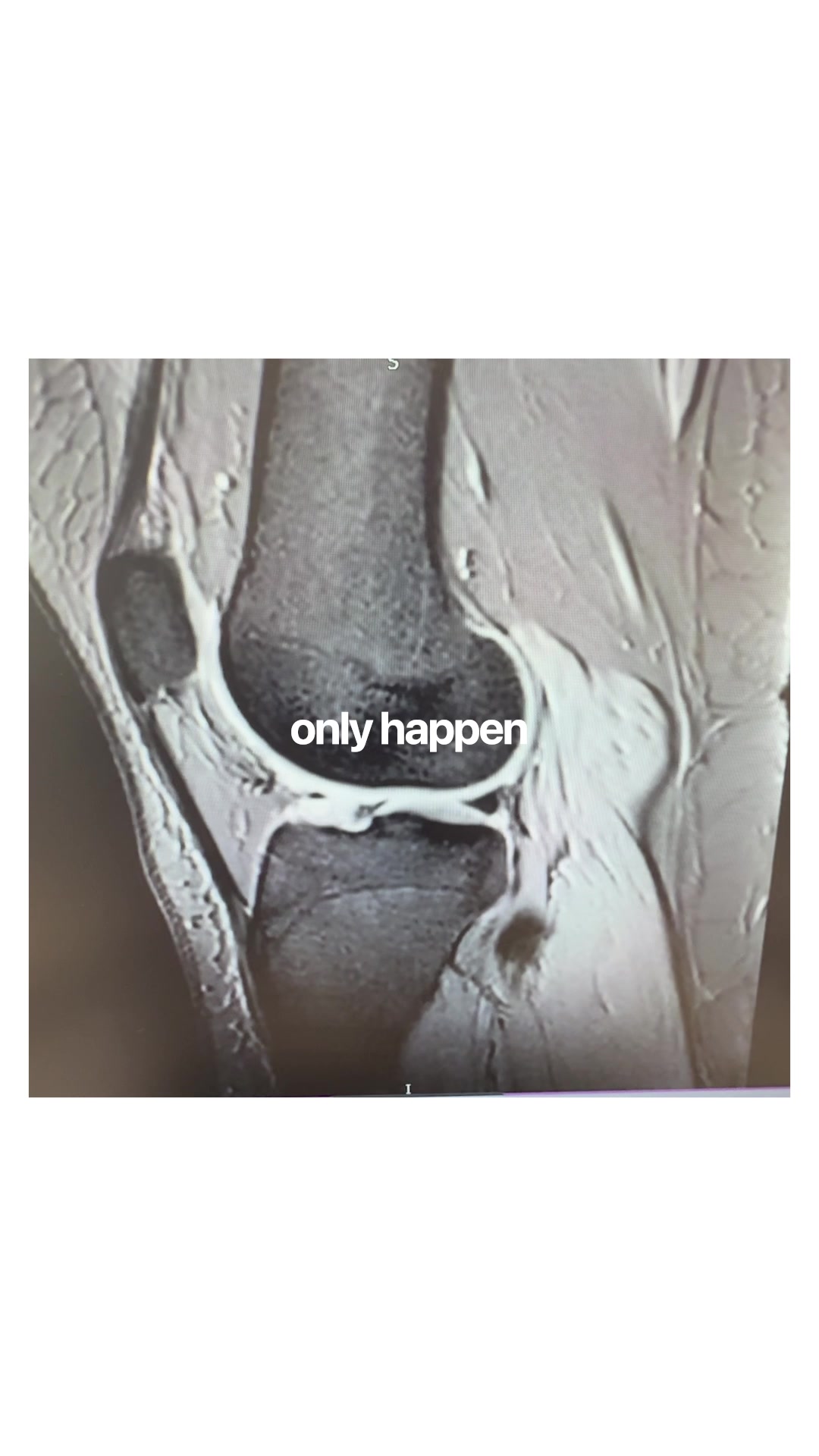 @YorkshireSportsKneeClinic