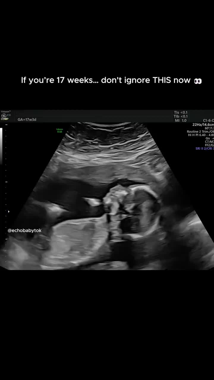 @Echobaby