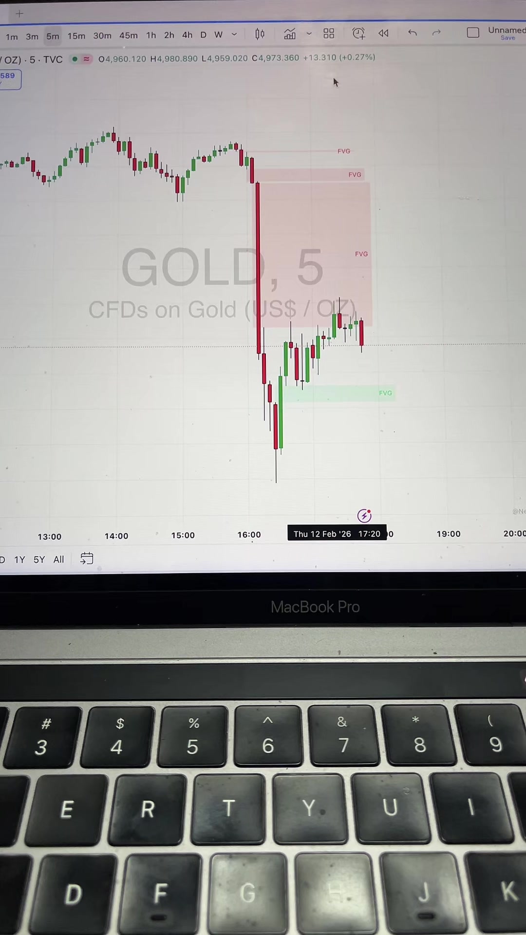@Rayyanxauusd