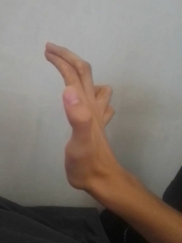 @Roruno