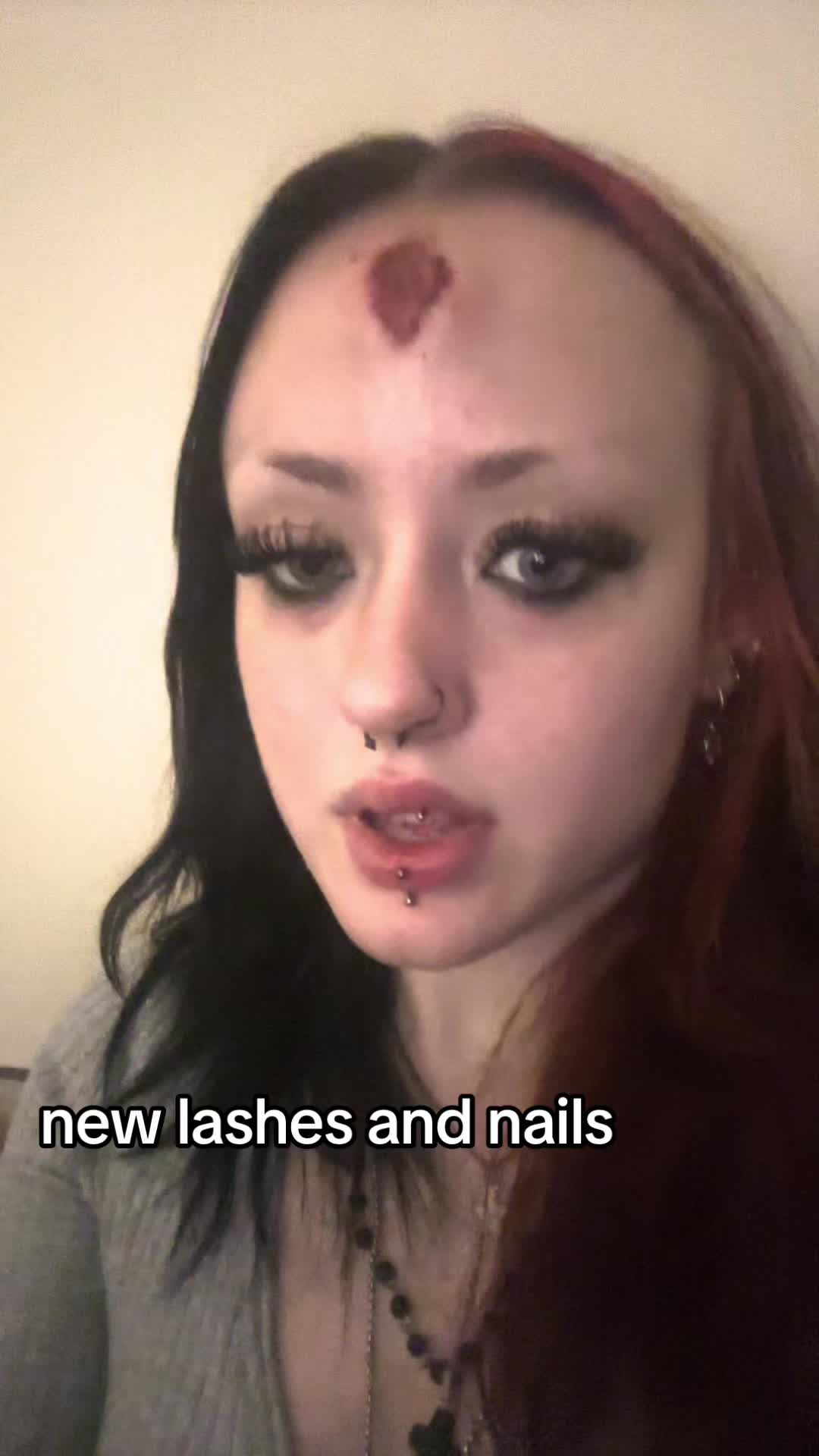 @katieseupdrecovery