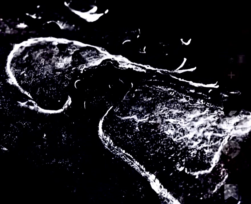 @La vida loca
