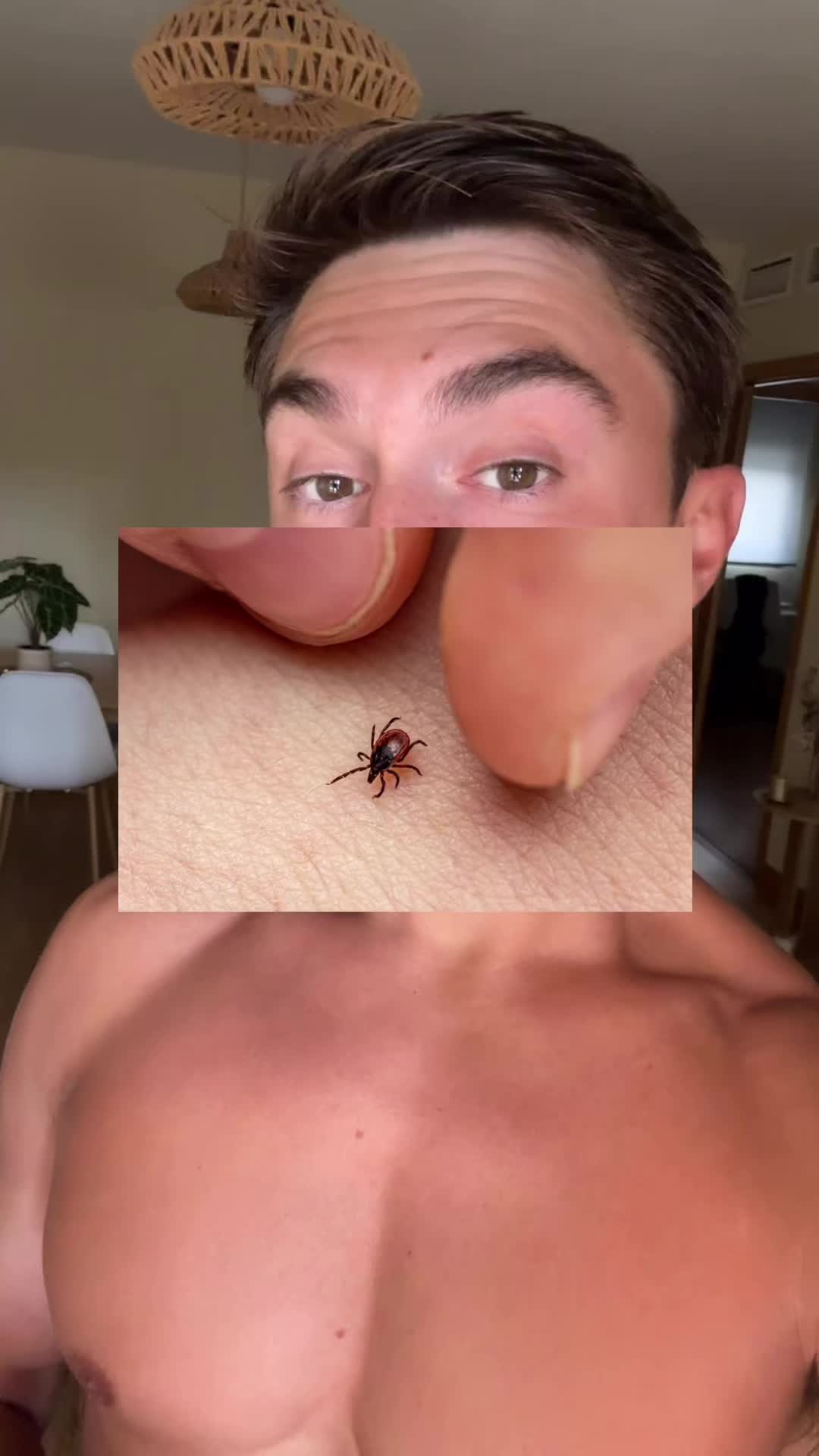 @DietAlvaro