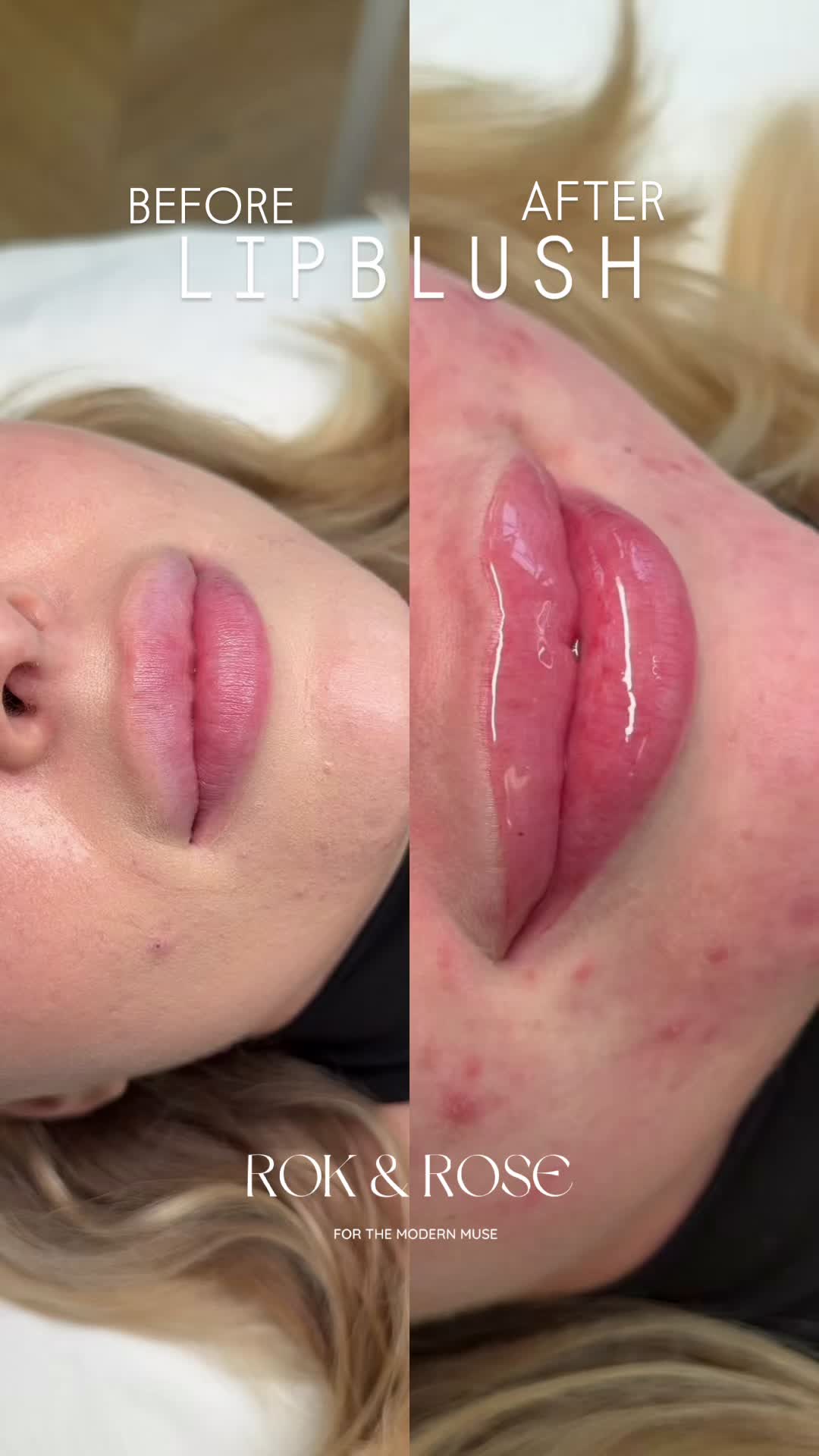 @Rebecca Teasdale | Lip Blush