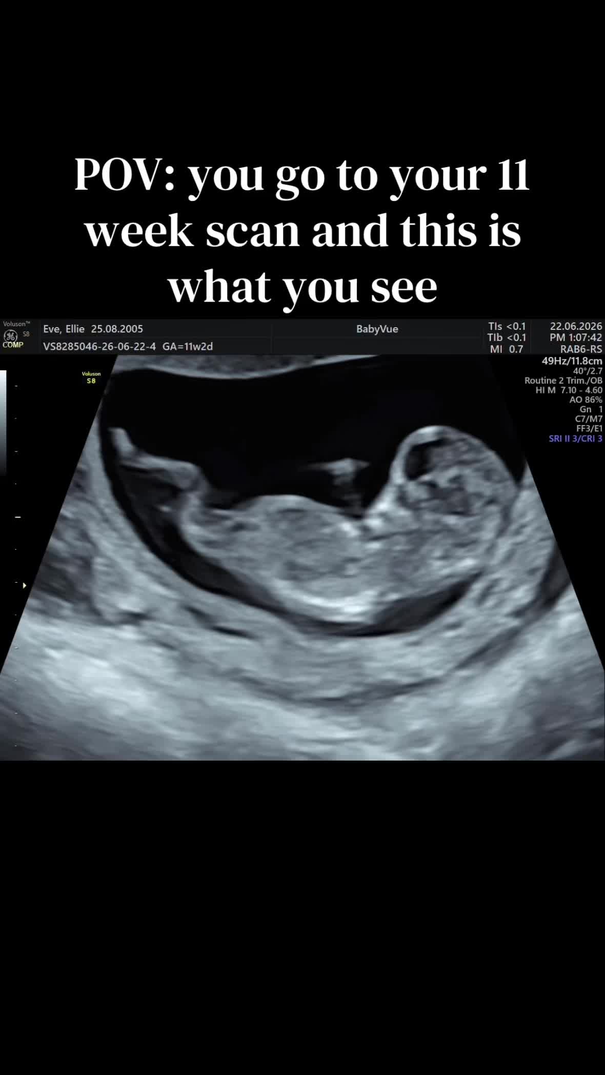 @𝐄𝐥𝐥~Boy Mama to Be🩵🤰🏼