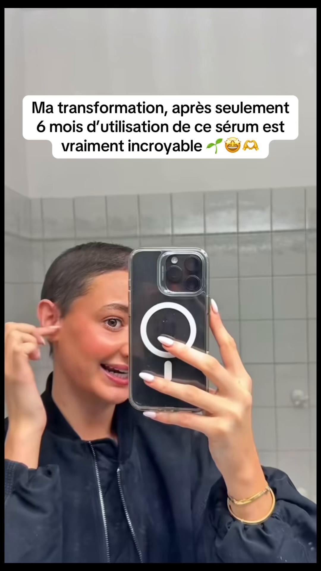 @Lux’Hair Growth