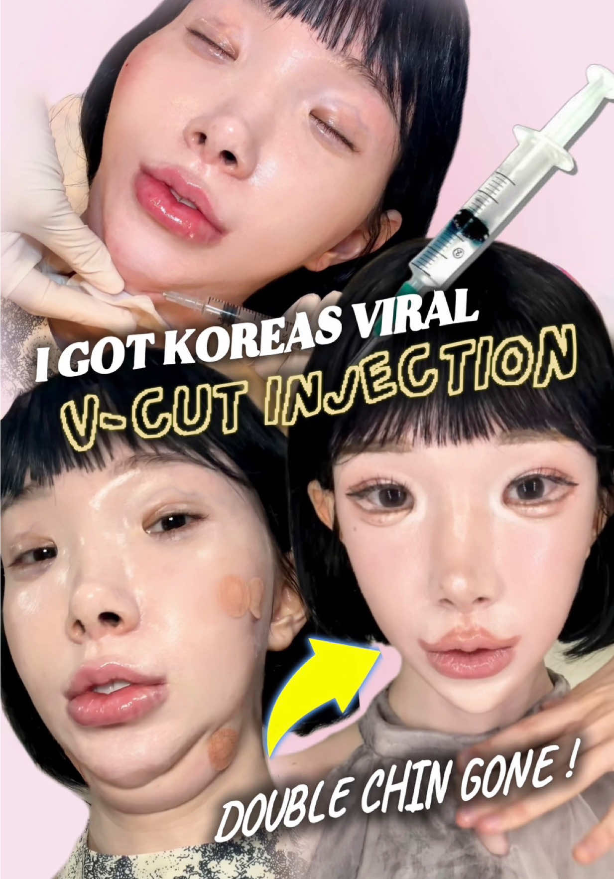 @Lisa Yo
