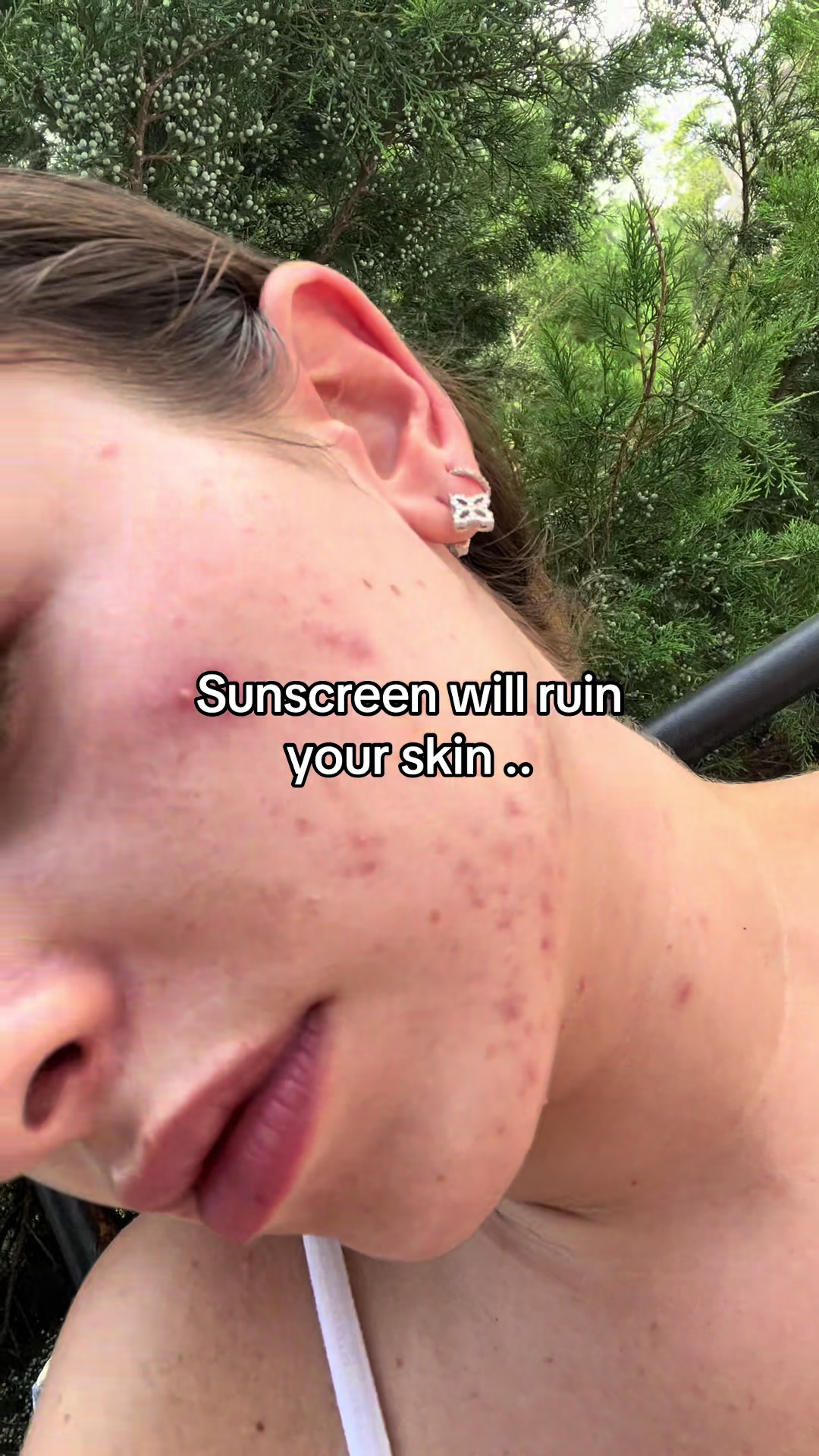 @Dani